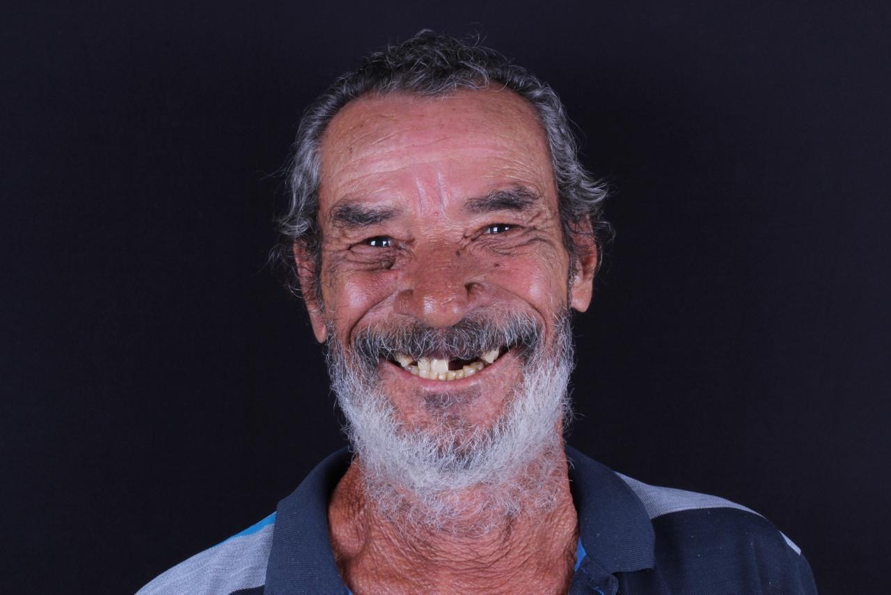 Dentes Estragados - Antes